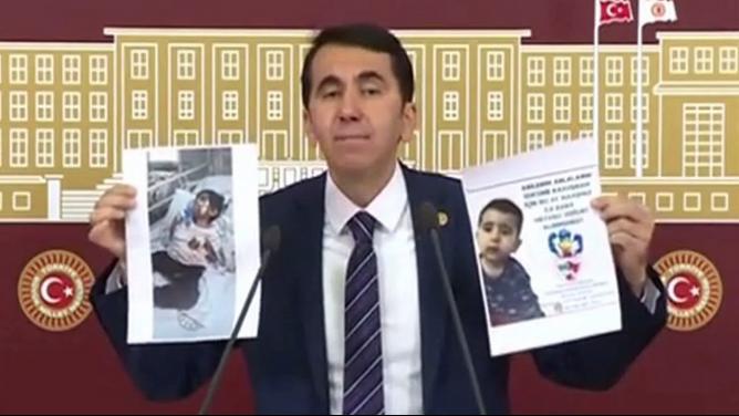 Milletvekili Topal SMA Hastası Yiğit Bebeğe Destek İstedi